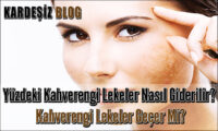 Yüzdeki Kahverengi Lekeler Nasıl Giderilir