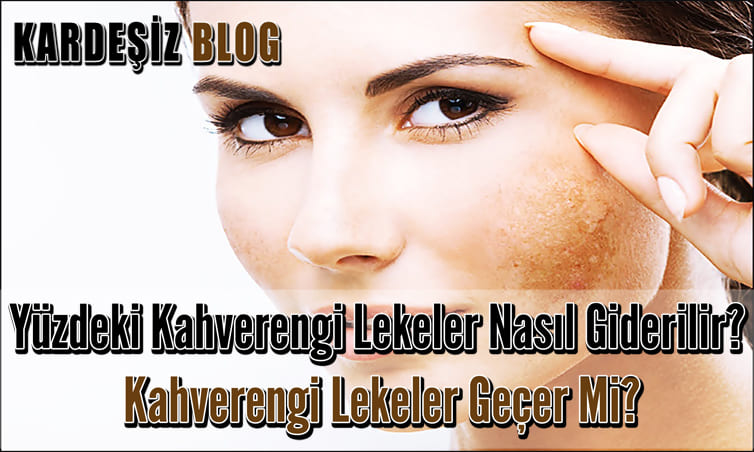 Yüzdeki Kahverengi Lekeler Nasıl Giderilir