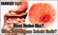 Ülser Neden Olur