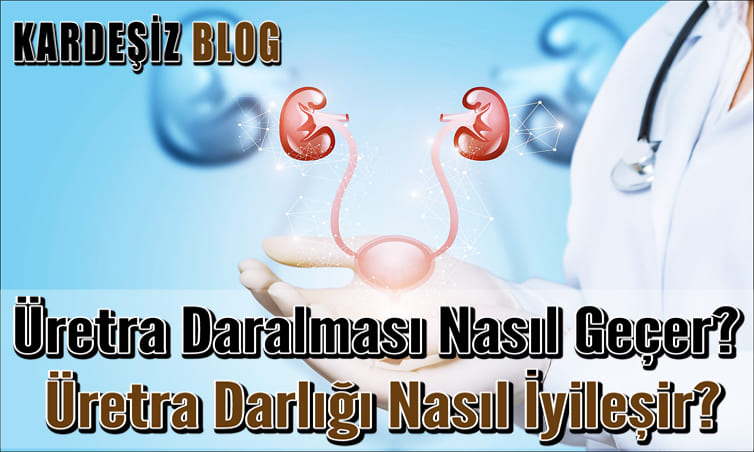Üretra Daralması Nasıl Geçer