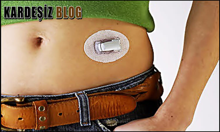 Diyabette Yapay Pankreas Cihazı Kullanılır Mı