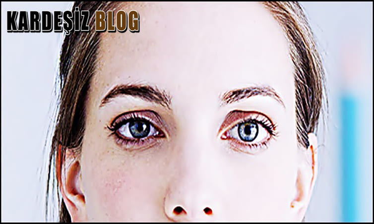 Göz Kaymasına Hangi Bölüm Bakar