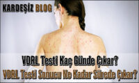 VDRL Testi Kaç Günde Çıkar