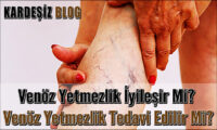 Venöz Yetmezlik iyileşir Mi