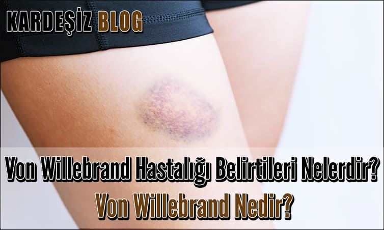 Von Willebrand Hastalığı Belirtileri Nelerdir