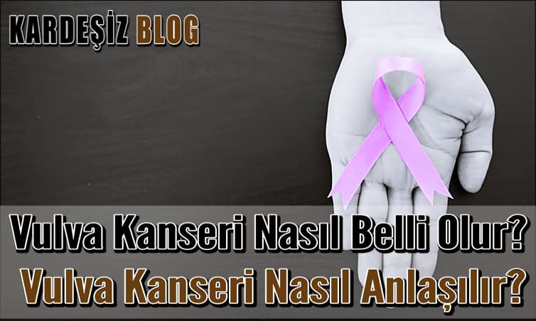 Vulva Kanseri Nasıl Belli Olur