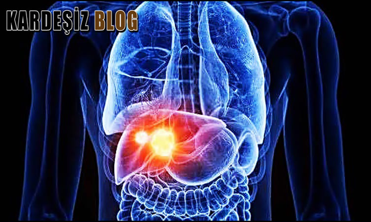 Wilson Hastalığı Nasıl Anlaşılır