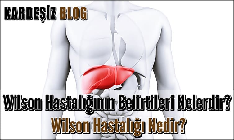 Wilson Hastalığının Belirtileri Nelerdir