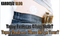 Yapay Pankreas Cihazı Nedir