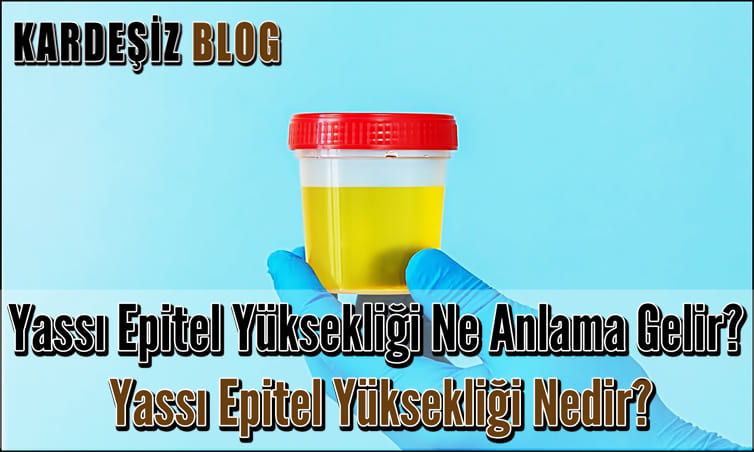 Yassı Epitel Yüksekliği Ne Anlama Gelir