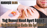 Yağ Bezesi Nasıl Ayırt Edilir