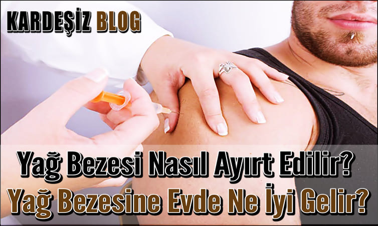 Yağ Bezesi Nasıl Ayırt Edilir