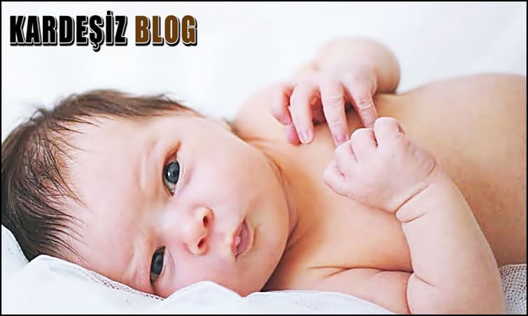 Yenidoğan Sarılığı Kaçıncı Gün Biter