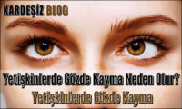 Yetişkinlerde Gözde Kayma Neden Olur