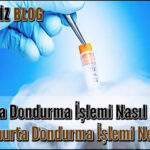Yumurta Dondurma işlemi Nasıl Oluyor