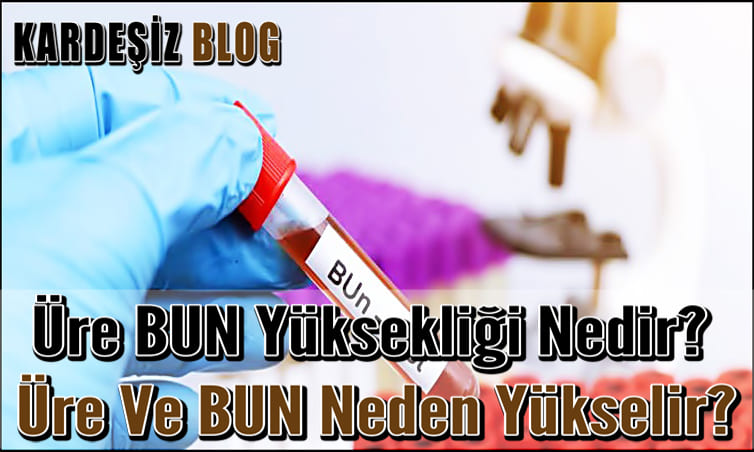 Üre BUN Yüksekliği Nedir