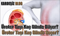 Üreter Taşı Kaç Günde Düşer