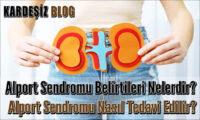 Alport Sendromu Belirtileri Nelerdir