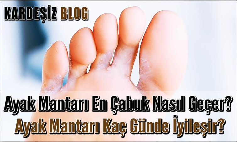 Ayak Mantarı En Çabuk Nasıl Geçer