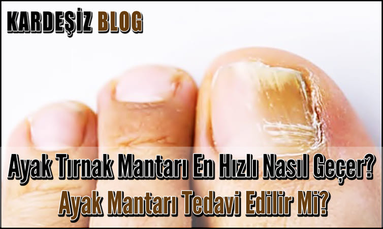 Ayak Tırnak Mantarı En Hızlı Nasıl Geçer