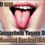 Ağız Kanserinde Yaşam Süresi