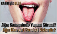 Ağız Kanserinde Yaşam Süresi