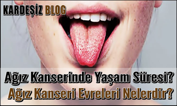 Ağız Kanserinde Yaşam Süresi