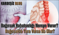 Bağırsak Rahatsızlığı Nereye Vurur