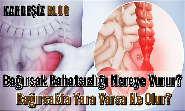 Bağırsak Rahatsızlığı Nereye Vurur