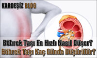Böbrek Taşı En Hızlı Nasıl Düşer