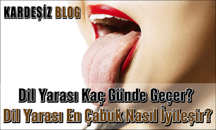 Dil Yarası Kaç Günde Geçer