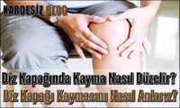 Diz Kapağında Kayma Nasıl Düzelir