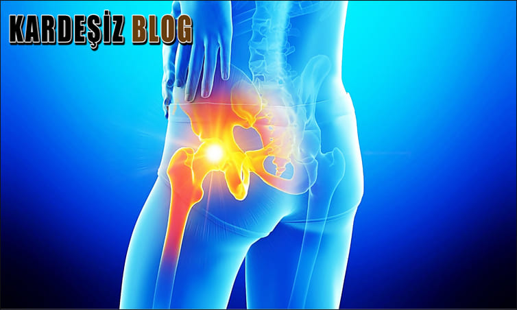 Kalça Kireçlenmesi Olanlar Nasıl Yatmalı