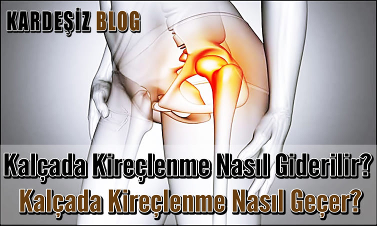 Kalçada Kireçlenme Nasıl Giderilir