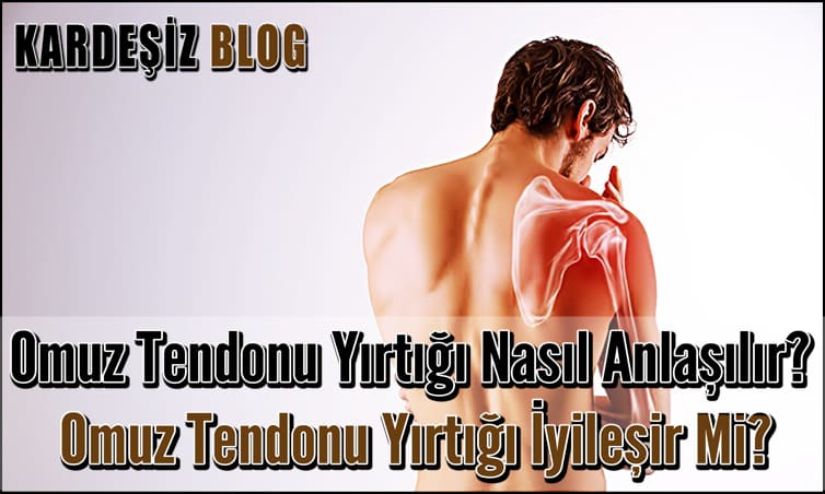 Omuz Tendonu Yırtığı Nasıl Anlaşılır