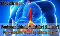 Pankreas iltihabı Belirtileri Nelerdir