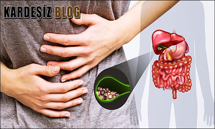 Safra Kesesi Hangi Yiyecekler Rahatsız Eder