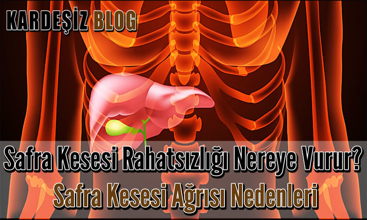 Safra Kesesi Rahatsızlığı Nereye Vurur