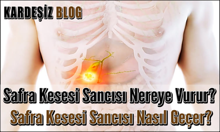 Safra Kesesi Sancısı Nereye Vurur