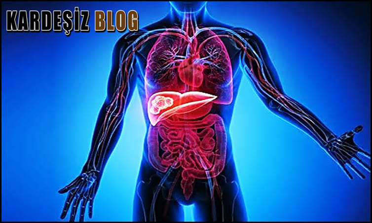 Sirke İçmek Karaciğere İyi Gelir Mi