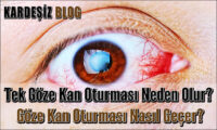 Tek Göze Kan Oturması Neden Olur