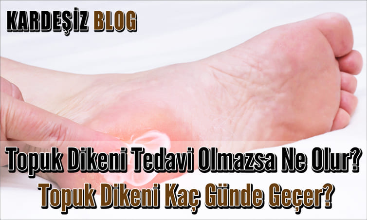 Topuk Dikeni Tedavi Olmazsa Ne Olur