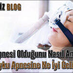 Uyku Apnesi Olduğunu Nasıl Anlarsın