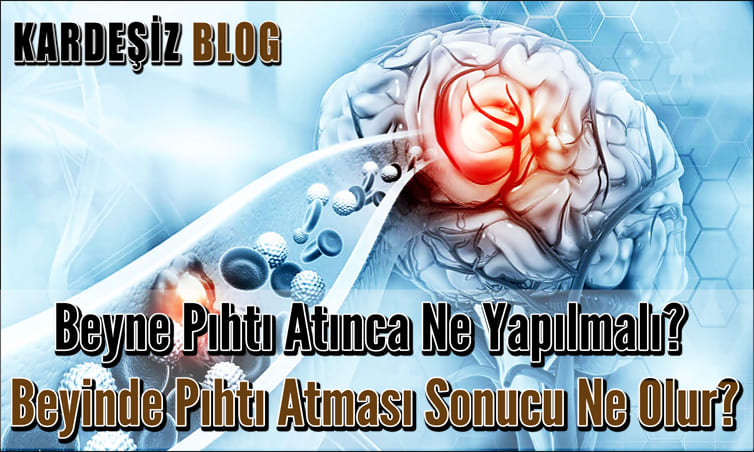 Beyne Pıhtı Atınca Ne Yapılmalı